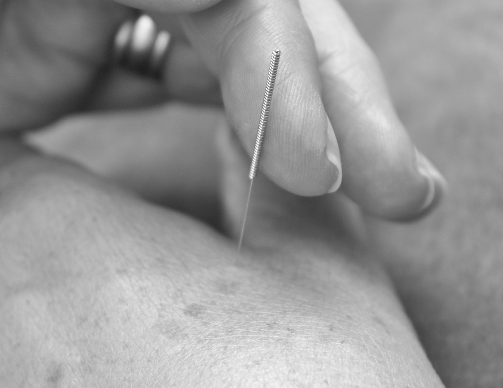 Gaynor Hollis Acupuncture (Airmed Acupuncture)