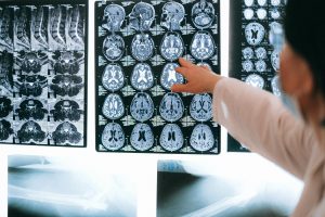 5 Best Neurologists in Glasgow