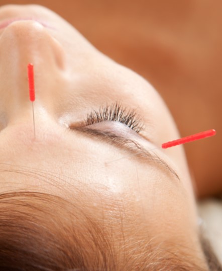 Ann Gilbertson Acupuncture